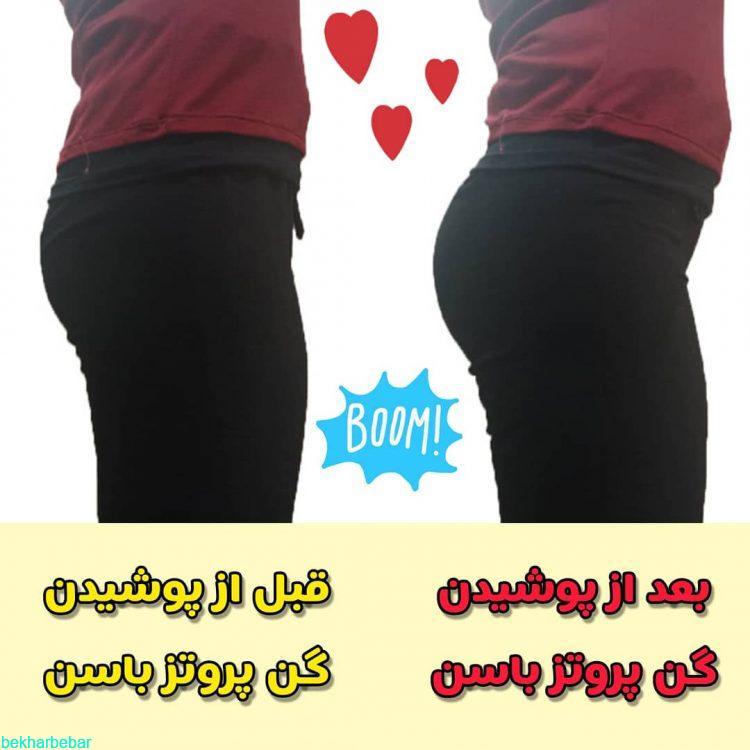 گن پروتز حجم دهنده باسن و بغل ران