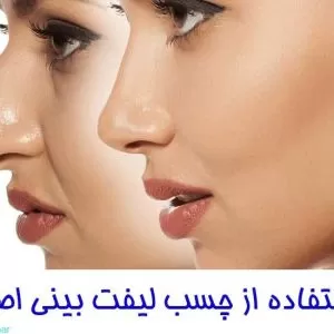 استفاده از چسب لیفت بینی