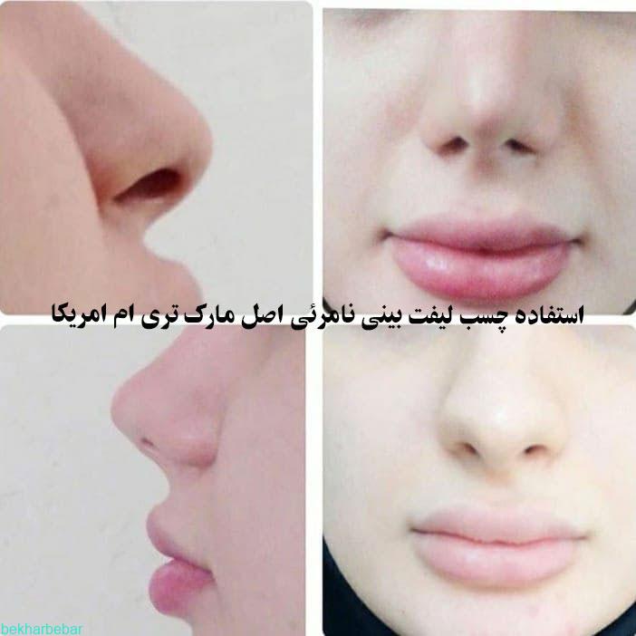 چسب بالا برنده بینی های گوشتی