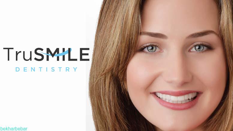 لمینت متحرک تورو اسمایل