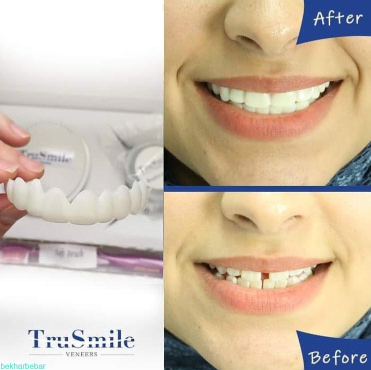 استفاده از لمینت متحرک دندان