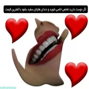 لمینت متحرک دندان