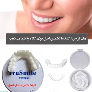 لمینت متحرک دندان