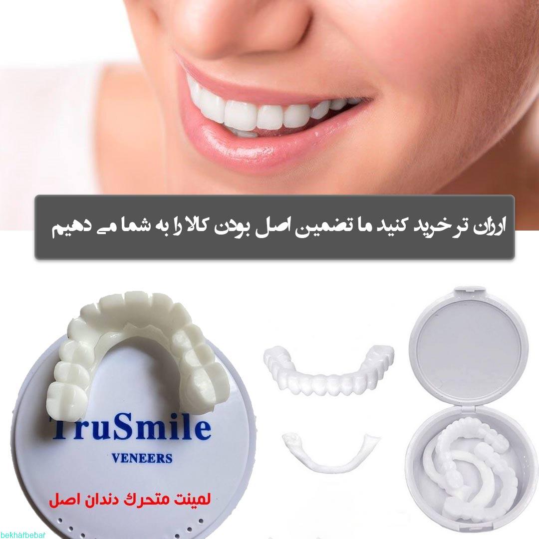 لمینت متحرک دندان