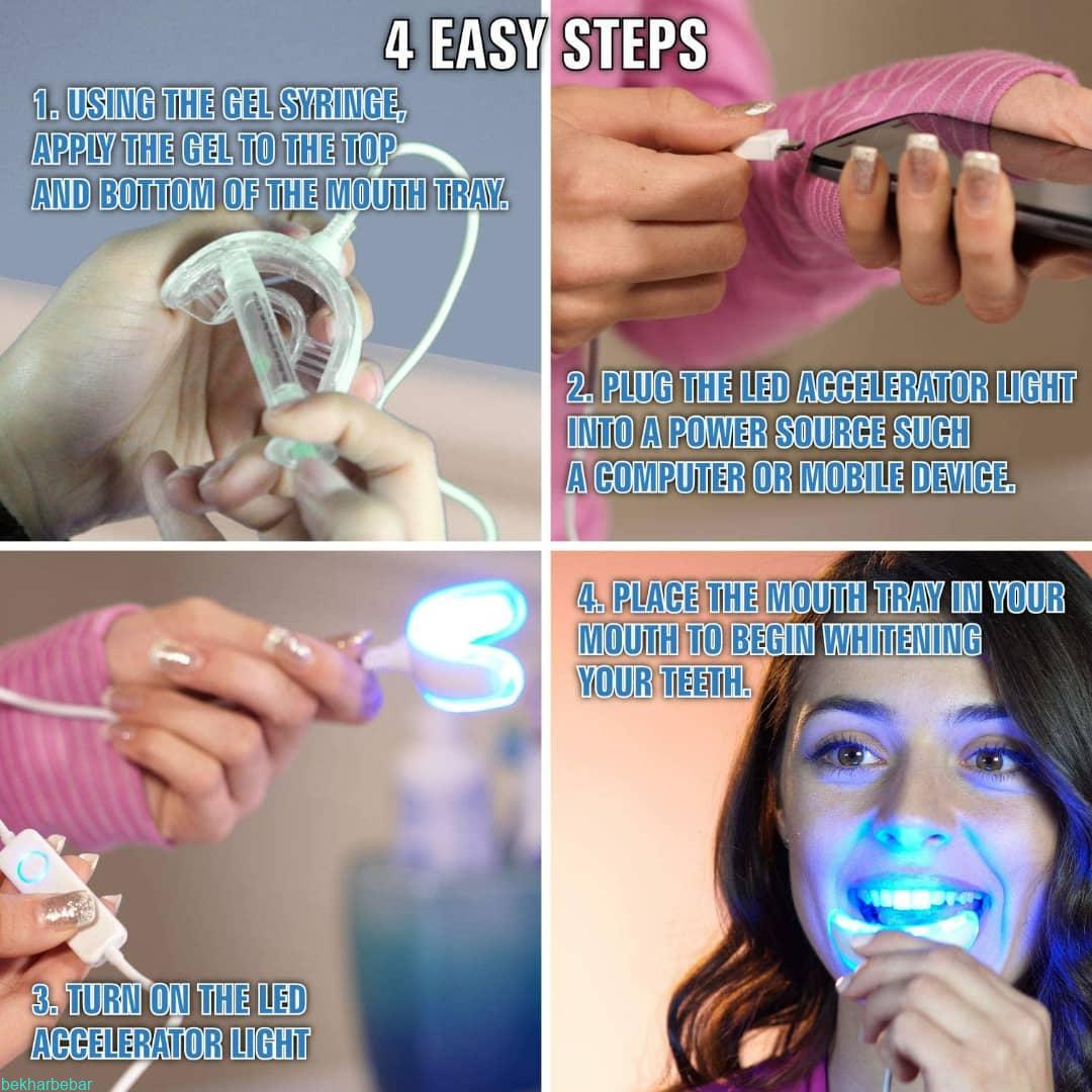 خرید بلیچینگ دندان در منزل بلیچ حرفه ای سفید کننده دندان 2025