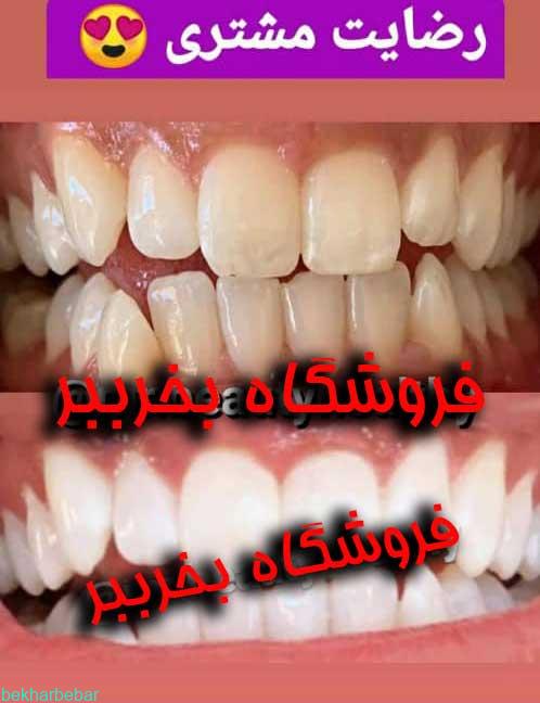 بلیچینگ خانگی دندان هنگام استفاده