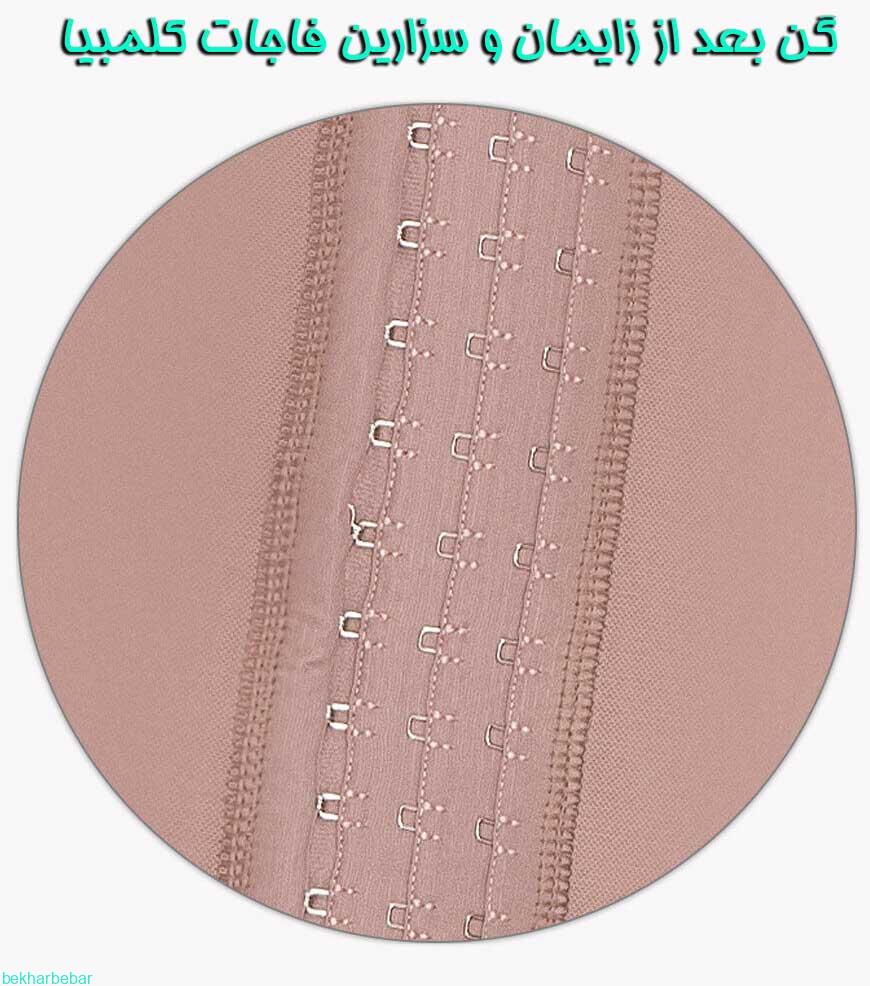 گن بعد از زایمان چگونه کار می کند؟