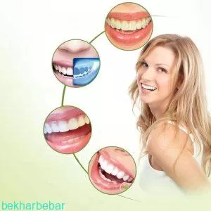 مزایای استفاده از لمینت اسنپ ان اسمایل