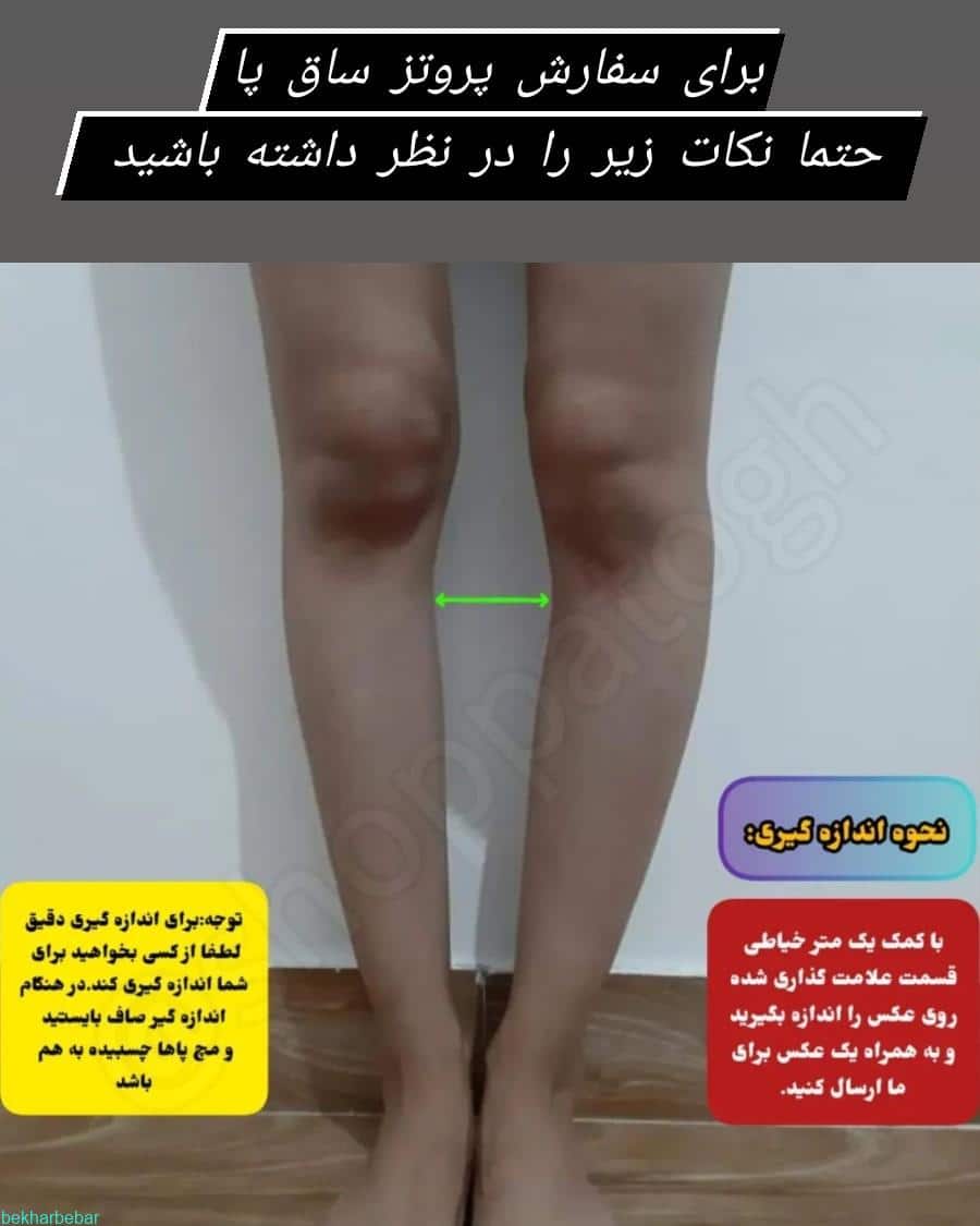 طرز سایزبندی پروتز ساق پا