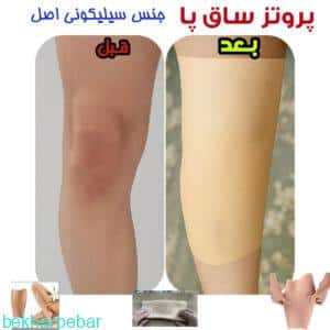 پروتز پوشیدنی ساق پا
