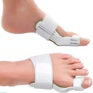اصلاح کننده قوز انگشت پا