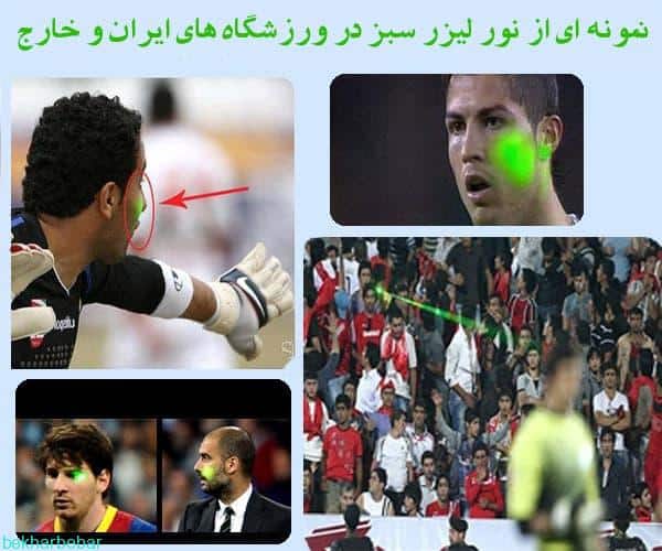 مزایای لیزر سبز حرارتی