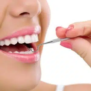 بهترین کیت تمیز کننده دندان