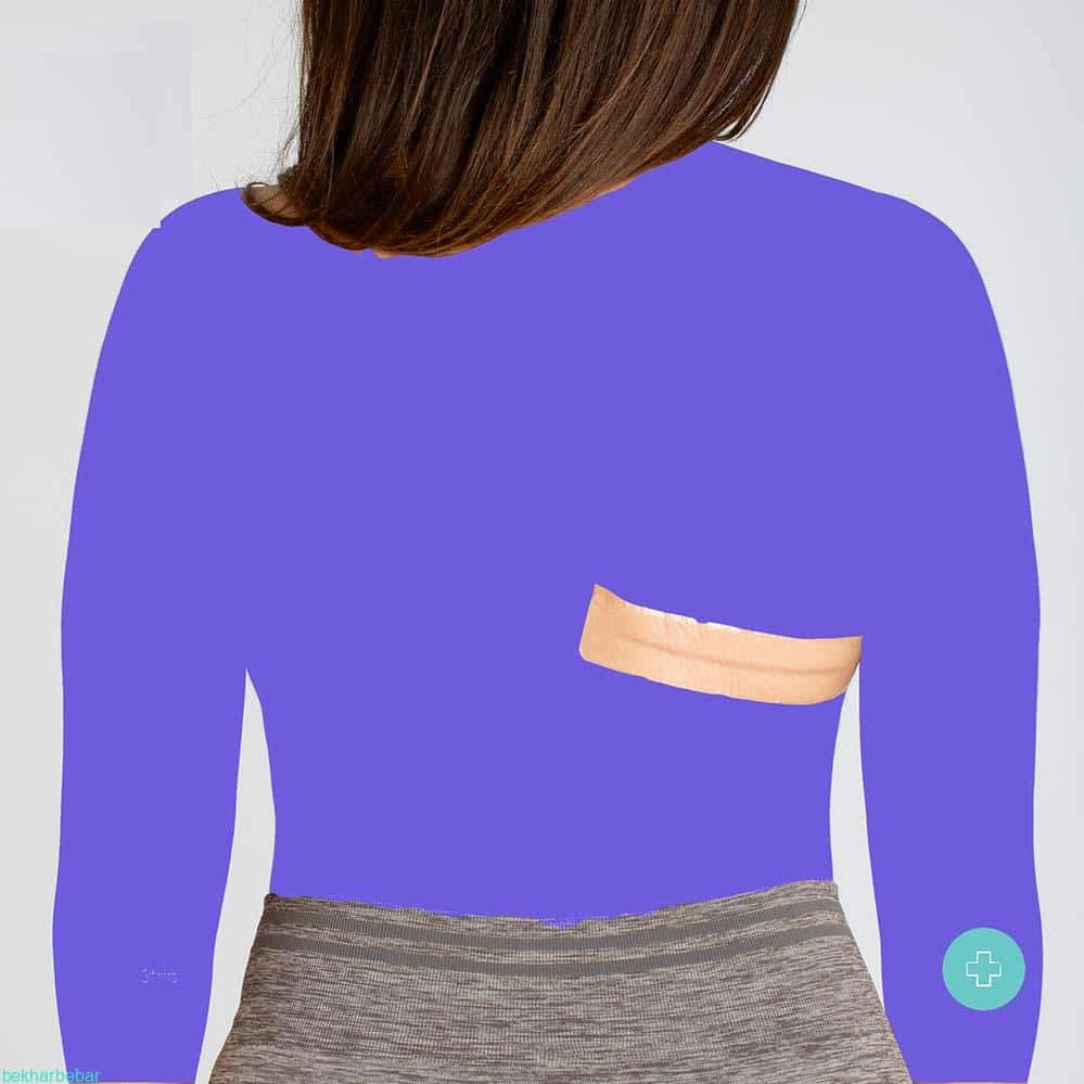 چسب ترمیم جای زخم اصل آلمان