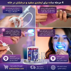 مراحل سفید کردن دندان با هوم بلیچینگ