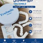 لمینت متحرک دندان ترو اسمایل