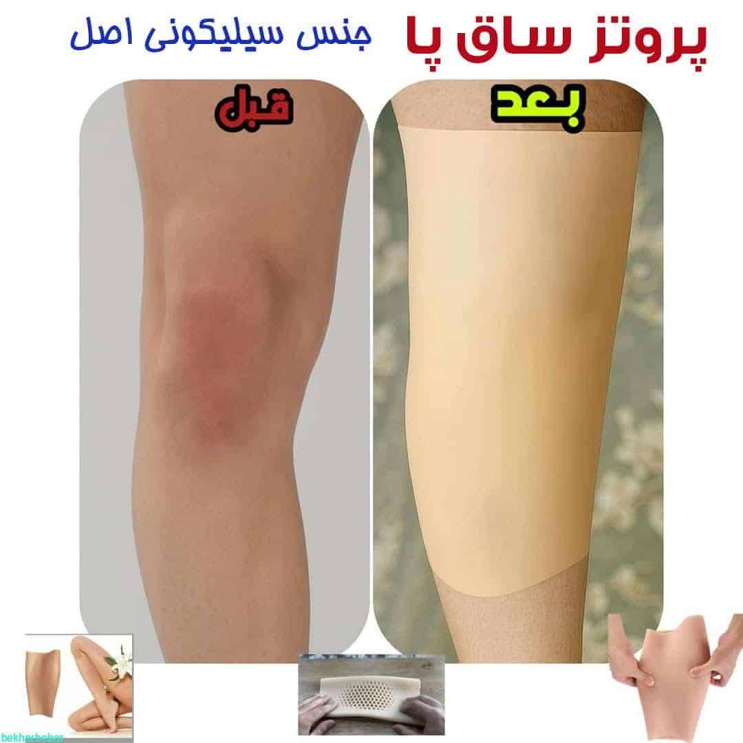 پروتز ساق پا سیلیکونی ژله ای پوشیدنی